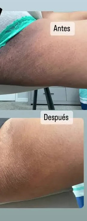 Resultado real