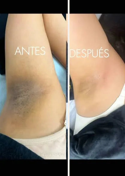 Resultado real